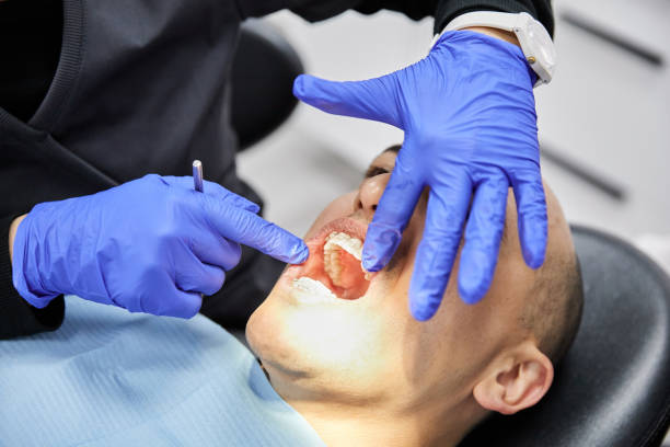 Best Broken or Chipped Tooth Repair in East Shoreham, NY